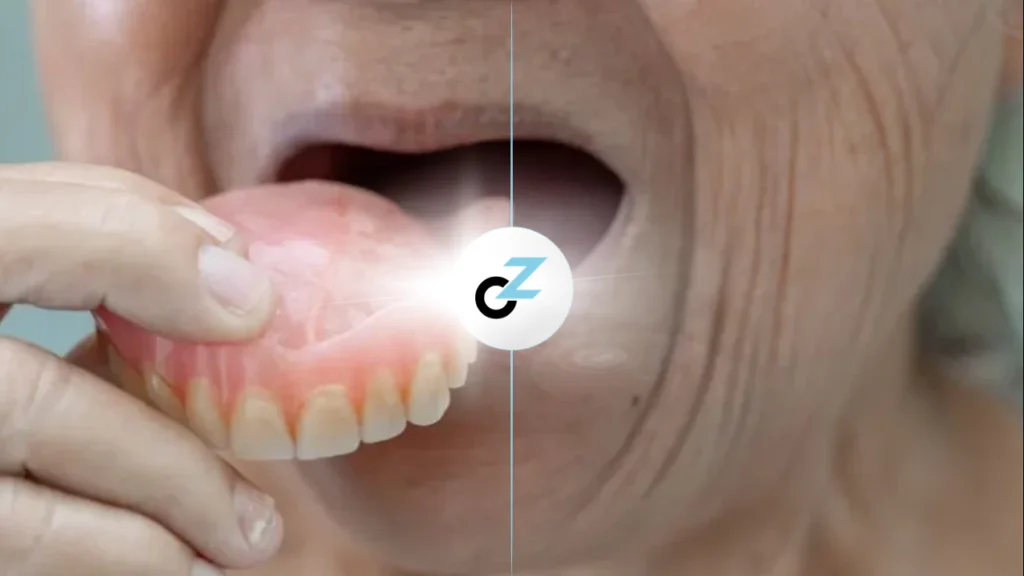 Prótese Total: Como Funciona a Dentadura Completa?