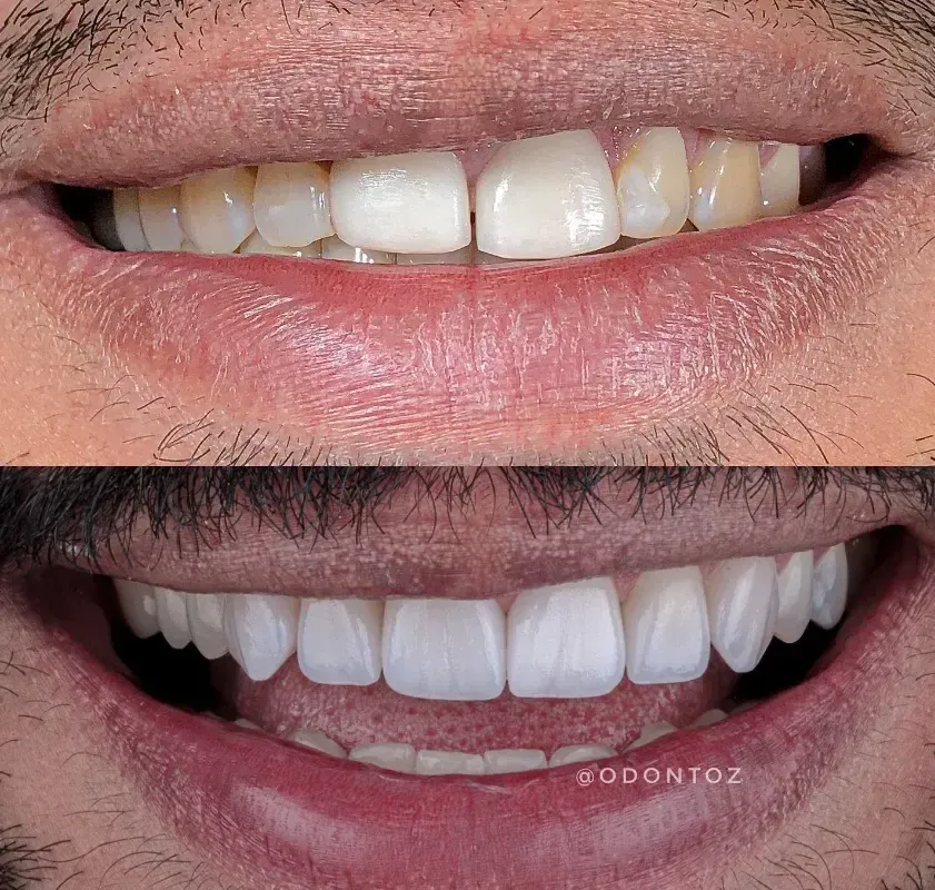 Expectativas e cuidados durante o tratamento ortodôntico