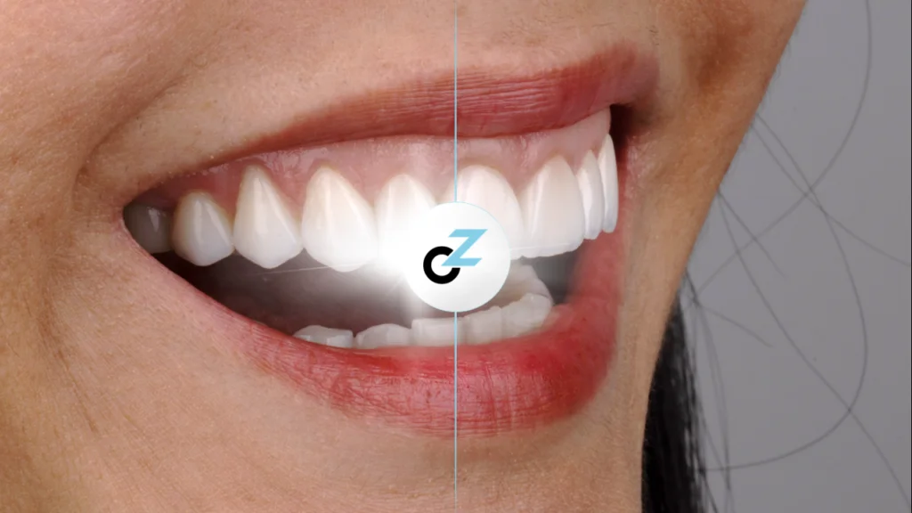 Periodontia: Tratamentos e Quando Procurar um Especialista