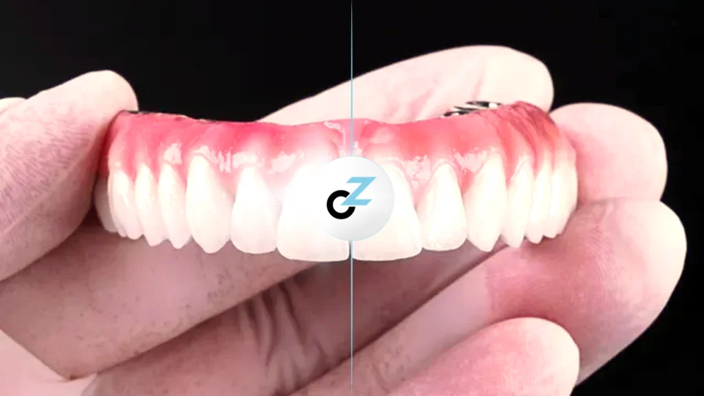 Prótese Protocolo: O Que é e Como Funciona?