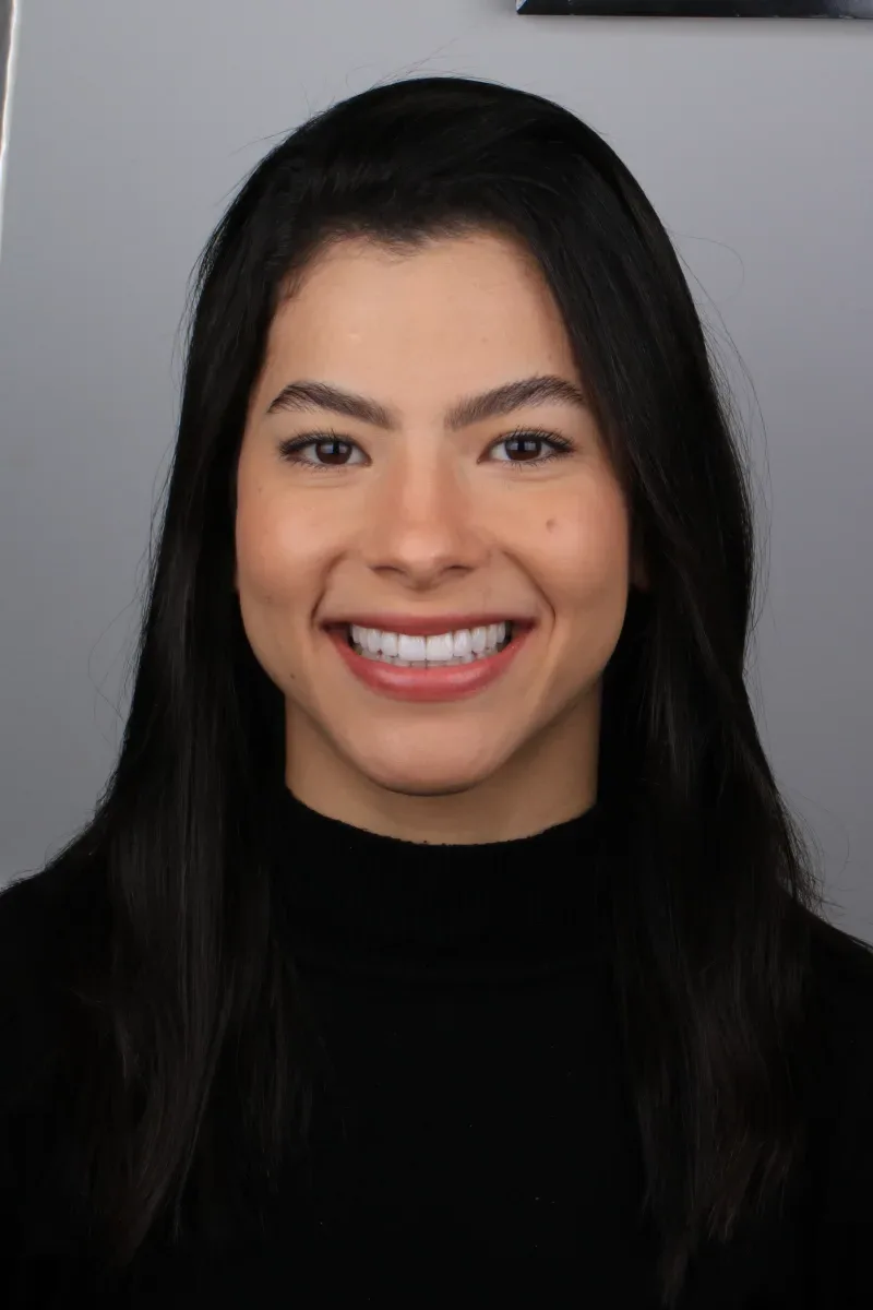 Ruth mostrando o resultado das lentes de contato dentais