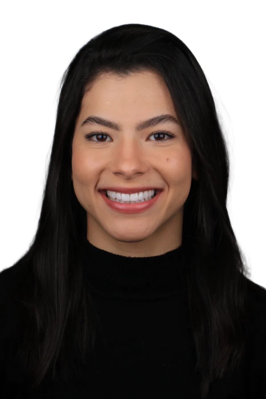 Ruth - paciente com lentes de contato dentais OdontoZ