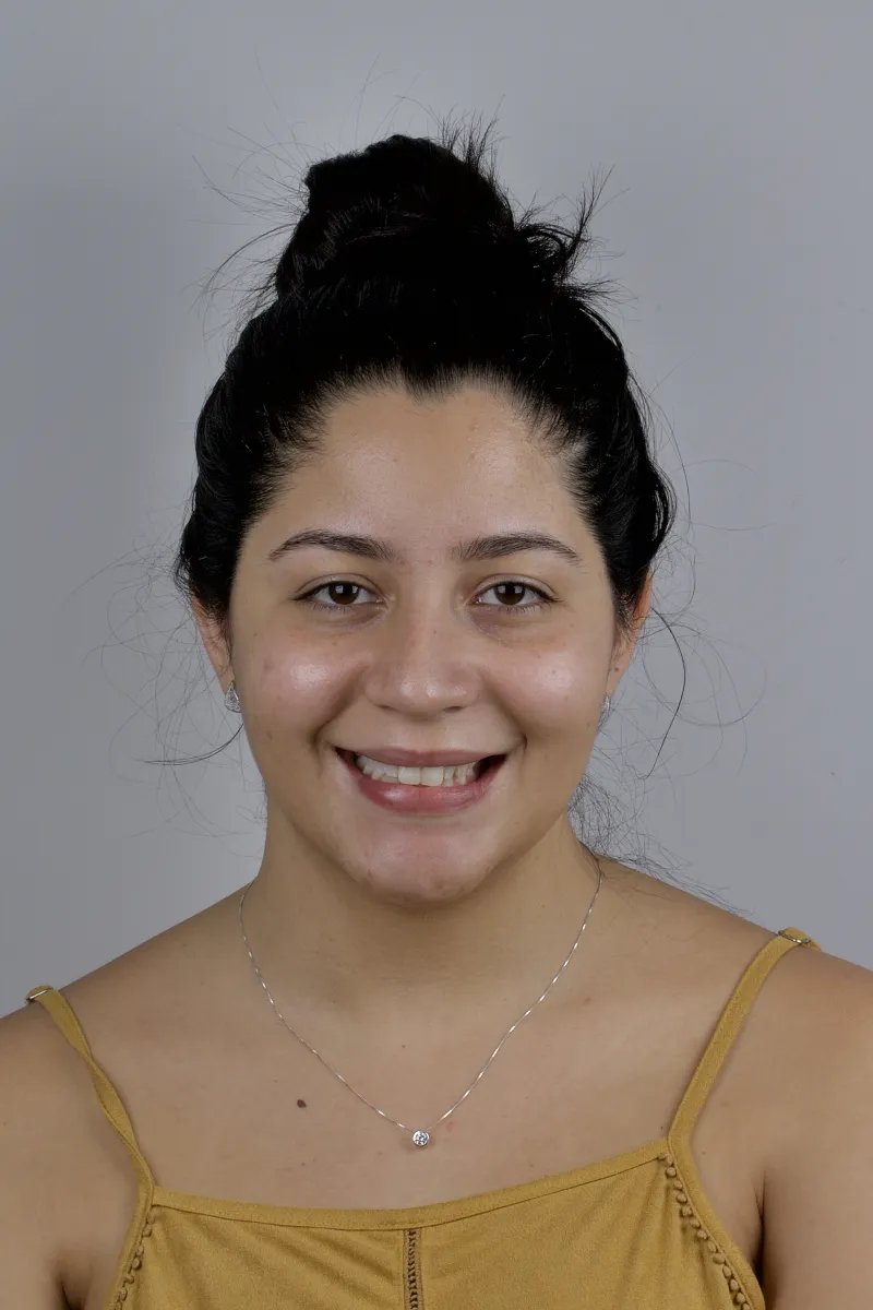 Rosto da Jéssica antes do tratamento com facetas de porcelana